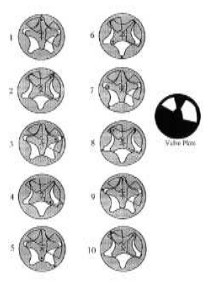 Diversas fases de trabajo del rotor